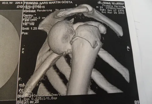 En annorlunda vintertur - del 6 (slutet)