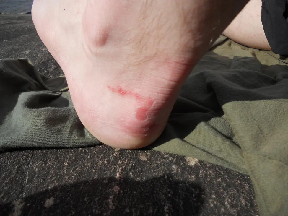 Klicka för att förstora